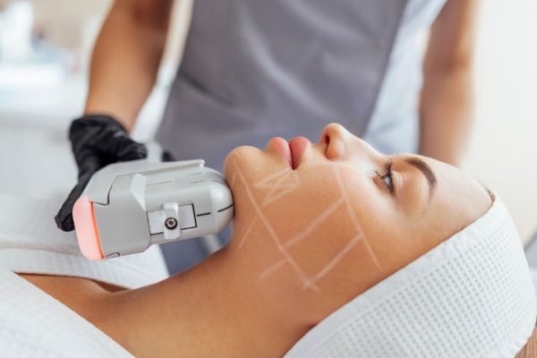 Acne Laser Treatment Toronto 4 hifu-treatment-skin-tightening